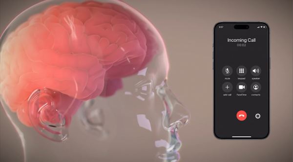 Компания Илона Маска начнёт массово чипировать людей: Neuralink планирует вживлять свои чипы 20 тысячам человек в год к 2031 году