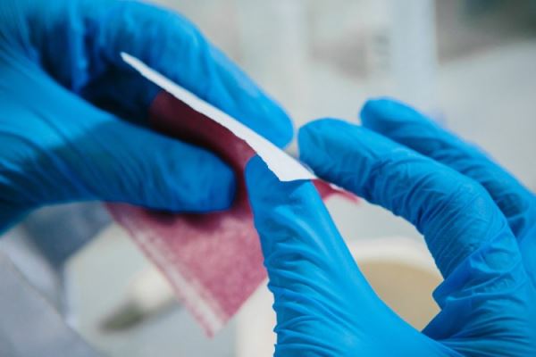 Польза наночастиц: от лечения хронических ран до очистки воды. Интервью с научным сотрудником МИСИС Кристиной Котяковой