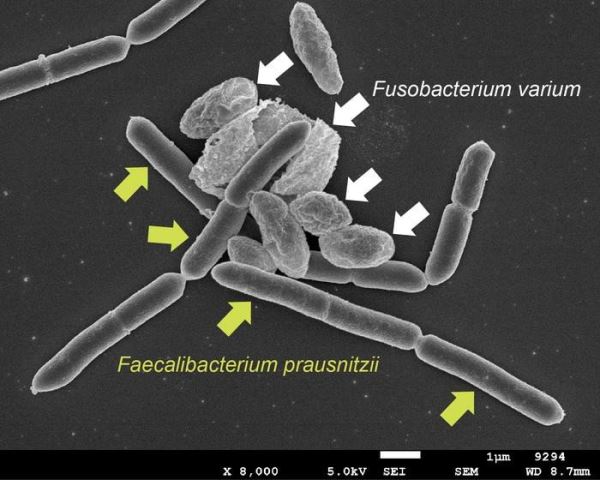 Раскрыт механизм взаимодействия бактерий в кишечнике